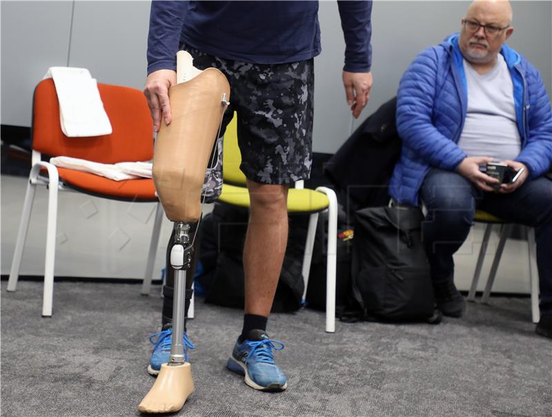 Udruga: Standard HZZO-a ne omogućuje kvalitetan život osobama s amputacijom